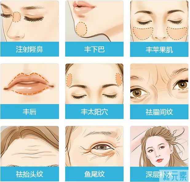 一分钟带你了解微整之玻尿酸的正确打开方式 图片-3