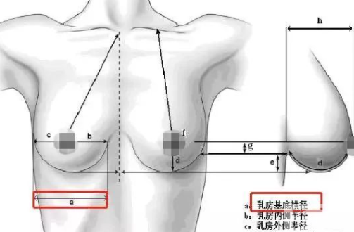假若我做了假体丰胸，男朋友会摸得出来吗? 图片-7