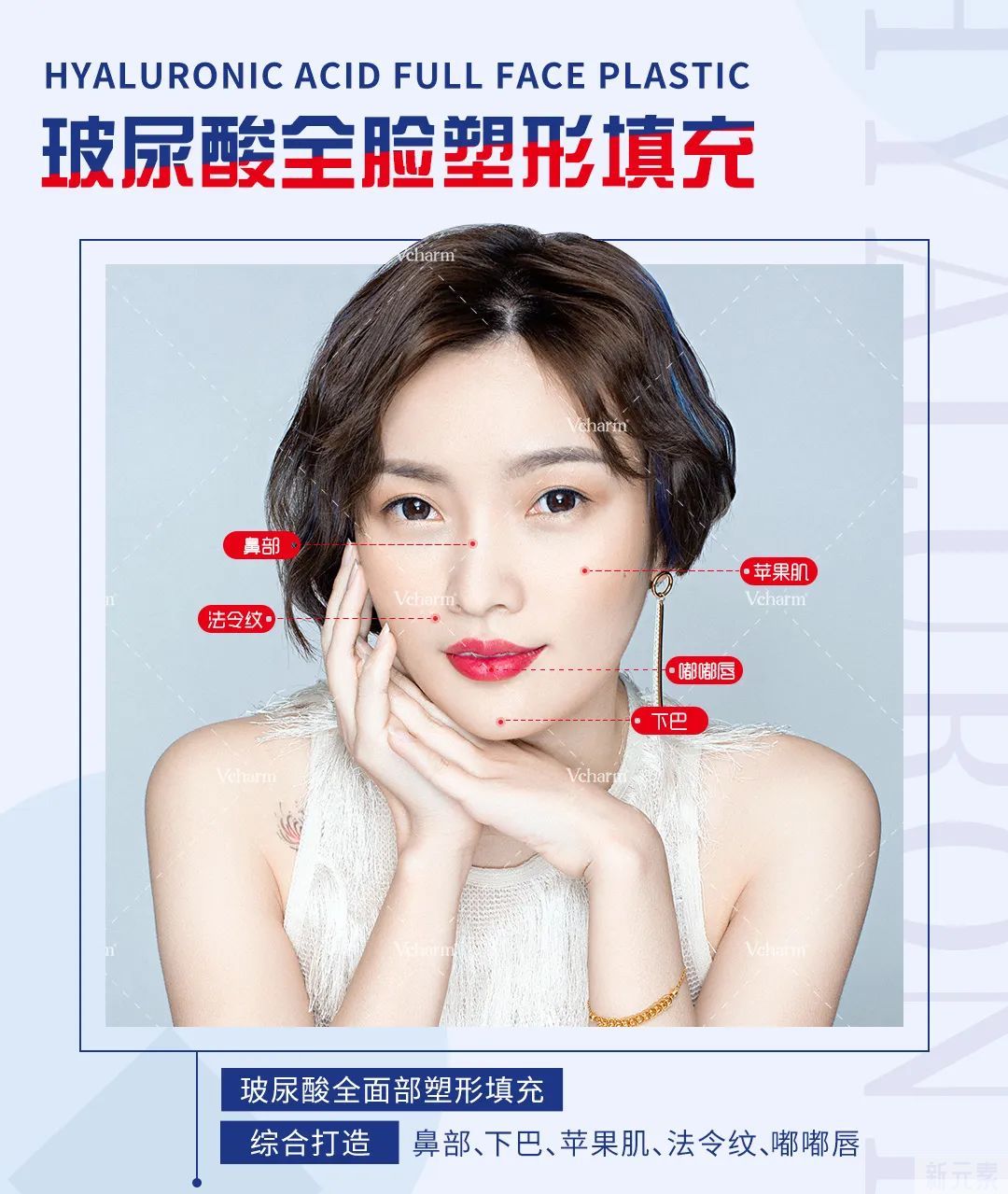 玻尿酸≠假面感，填充后更具高级感?! 图片-4