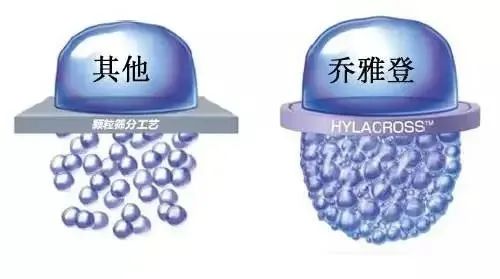 玻尿酸≠假面感，填充后更具高级感?! 图片-10