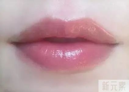 【医美小科普】嘟嘟唇和M唇可以保持多久?两者相比哪个好看? 图片-3