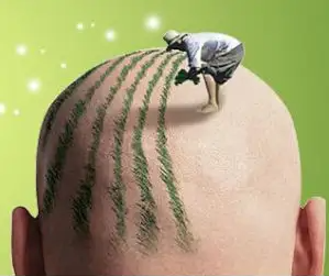 植发后这些细节不可忽视~ 图片-7