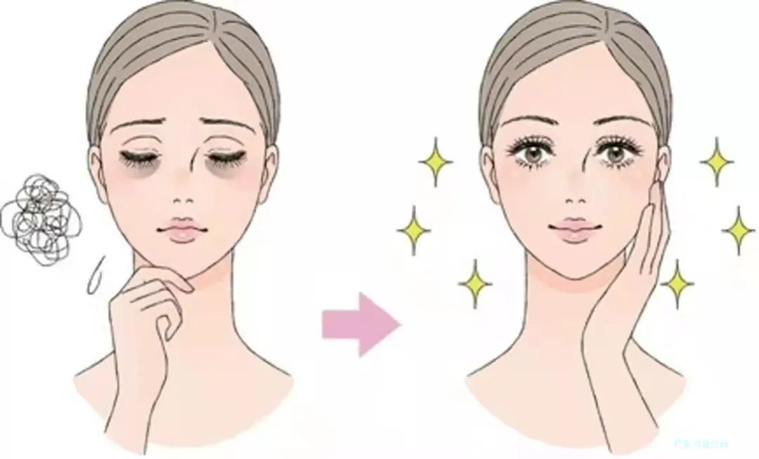 有了黑眼圈怎么办?黑眼圈真的是因为熬夜吗? 图片-1