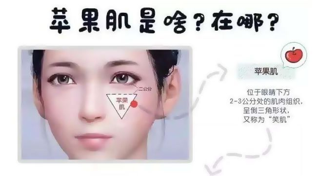 苹果肌、法令纹凹陷，要如何改善? 图片-4