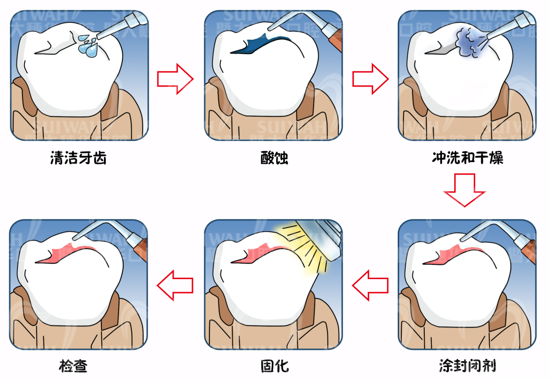 口腔体检报告看不懂?医生帮你“划重点”! 图片-7