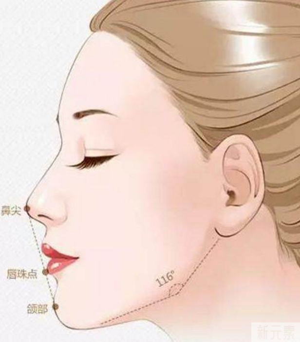 【零零后暑期整形科普系列】之面部轮廓整形 图片-1