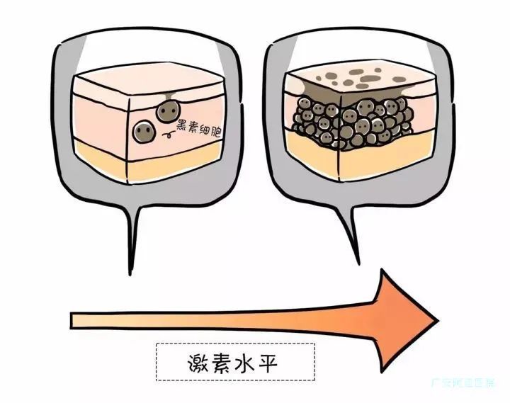 为什么女人脸上容易长斑? 图片-1
