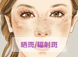 夏季不防晒，脸上会长多少斑?答案超乎你想象 图片-4