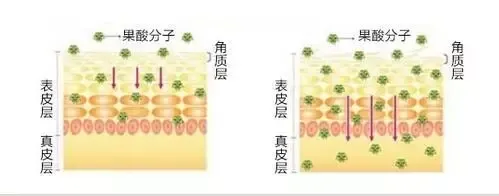从满脸痘痘到皮肤光滑，我做了这些事。 图片-9