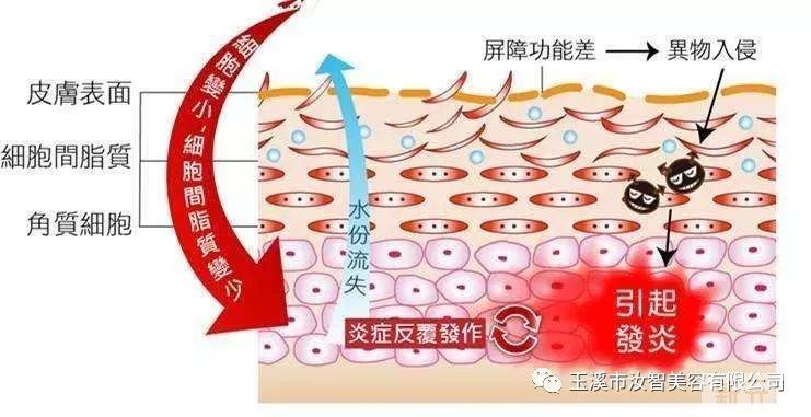 从满脸痘痘到皮肤光滑，我做了这些事。 图片-6