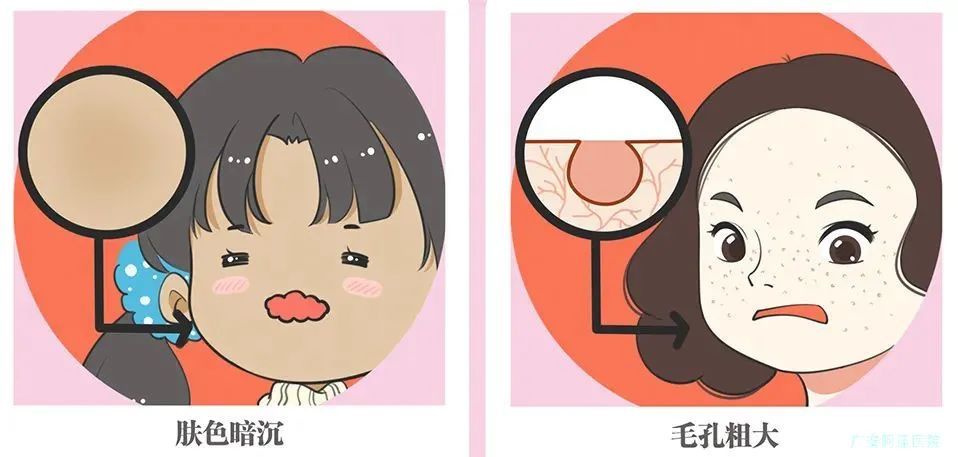 皮肤衰老的表现有哪些?如何延缓衰老? 图片-2