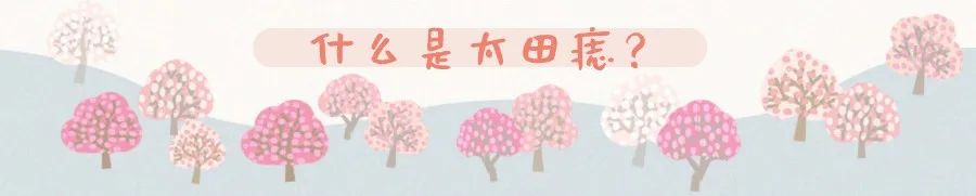 激光功能多治疗范围广，祛除面部这种痣目前是首选 图片-1
