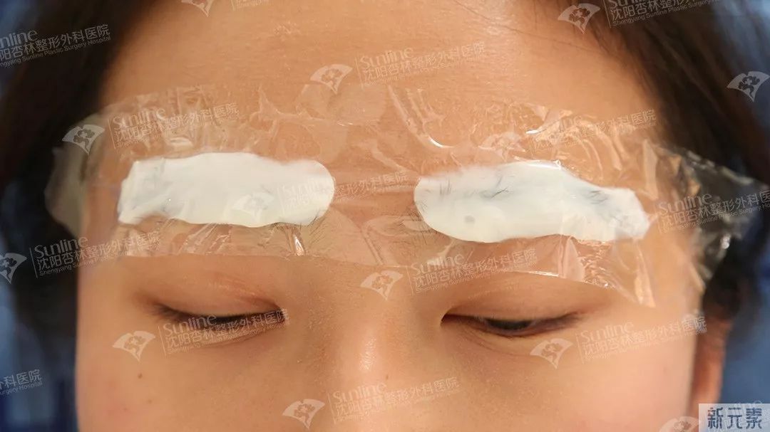 半永久纹绣必须要补色吗? 图片-3