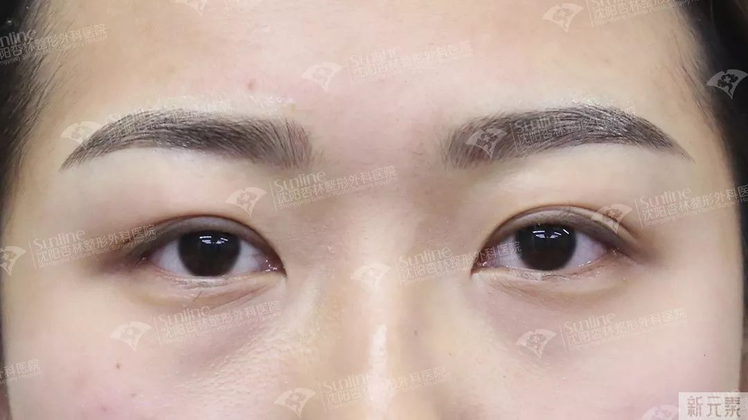 半永久纹绣必须要补色吗? 图片-5
