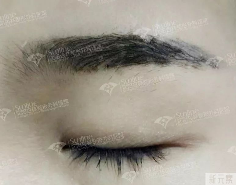 半永久纹绣必须要补色吗? 图片-7
