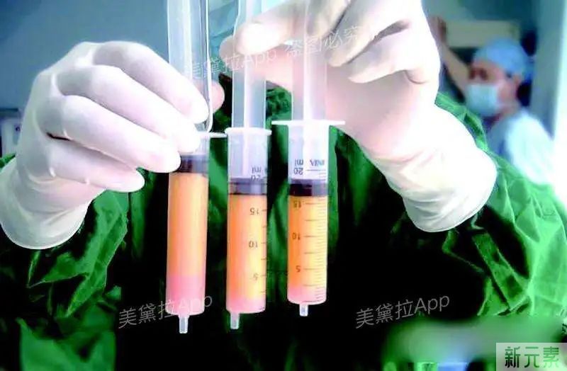 你还在穿束腰?快试试更轻松的瘦身方法!让脂肪去到该去的地方! 图片-8