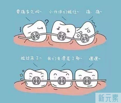 牙齿矫正前需要知道这些事儿 图片-3