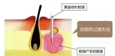 医美和护肤成分搭配一样，这样做1+1&gt;2?! 图片-6
