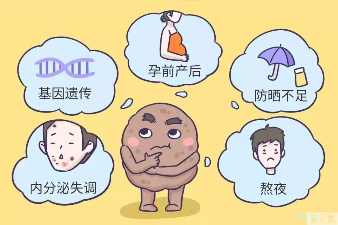 雀斑、晒斑、黄褐斑、老年斑......各种斑该怎么除? 图片-5