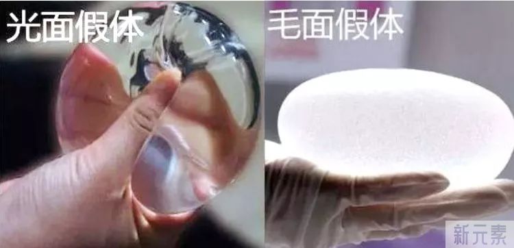 假体隆胸前你需要知道的几件事 图片-4