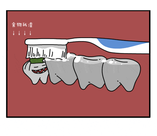 科普来了 | 拔智齿会导致牙齿松动吗? 图片-9