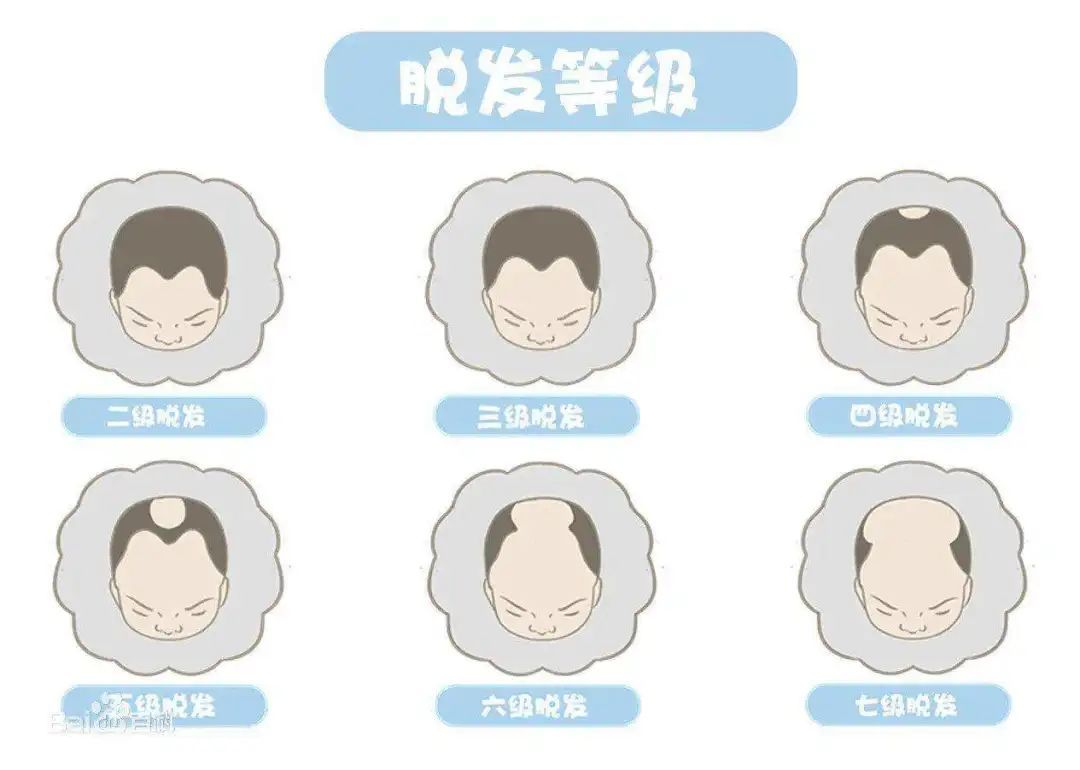 年纪轻轻经常脱发?可能是因为这些! 图片-4