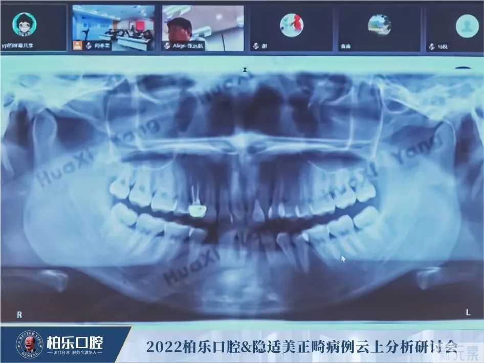 【学术柏乐】2022正畸病例云上分析研讨会隆重举行 图片-6