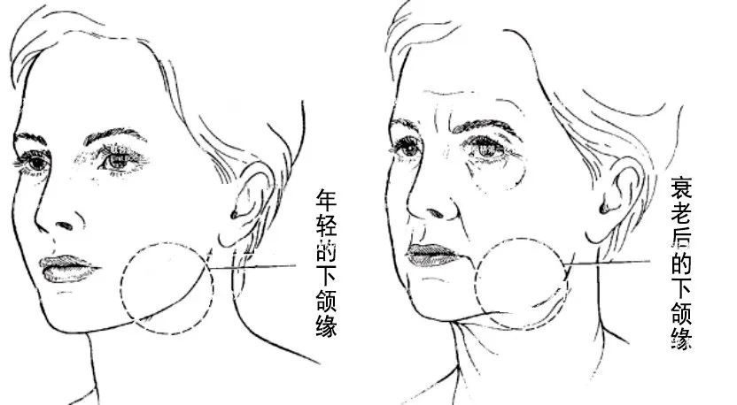科普 | 下颌轮廓模糊不清怎么办? 图片-5