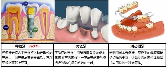 才缺一颗牙，有必要做种植牙吗? 图片-13