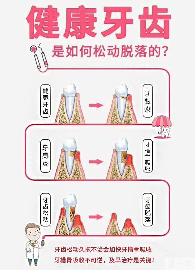 这些不起眼的小症状，竟能“侵蚀”一口好牙? 图片-6