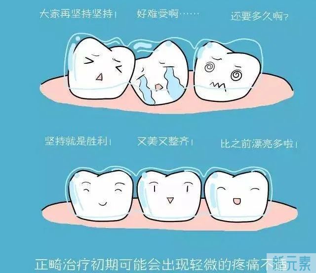 隐形牙套需要戴多久?没戴够时间相当于白戴? 图片-5