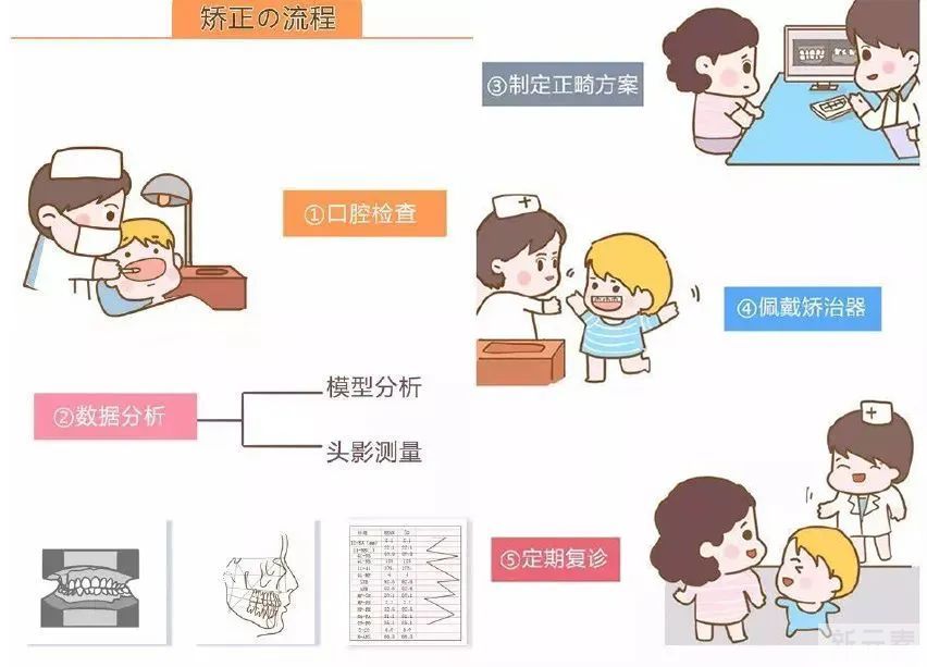 隐形牙套需要戴多久?没戴够时间相当于白戴? 图片-7