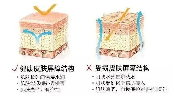 科普知识分享:关于皮肤屏障受损 图片-3