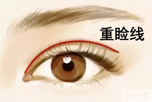 双眼皮失败的八种表现，你知道该如何应对吗? 图片-4