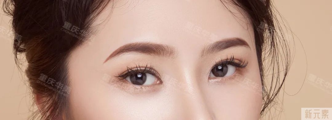 年轻人和中年人祛眼袋区别这么大?看完省了不少钱! 图片-4
