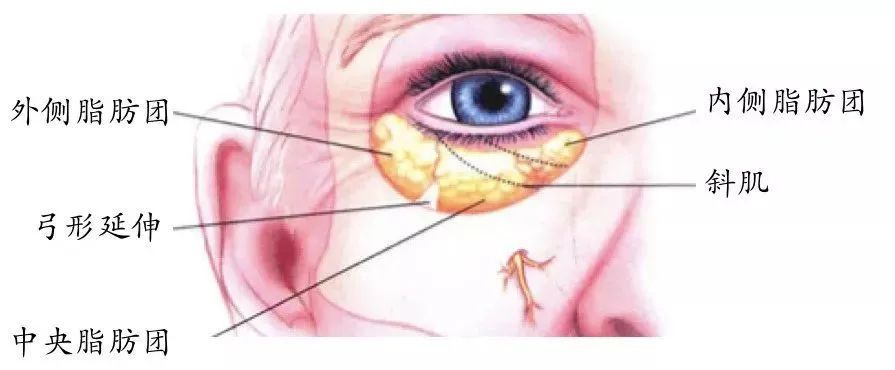 年轻人和中年人祛眼袋区别这么大?看完省了不少钱! 图片-7