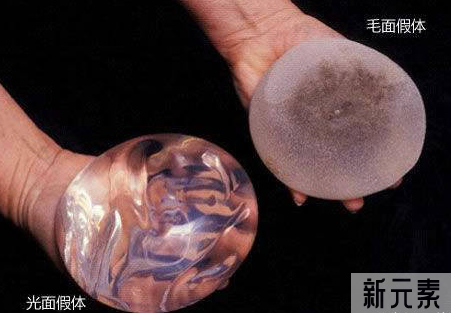 自体脂肪一定比假体好?隆胸材料该如何选? 图片-11