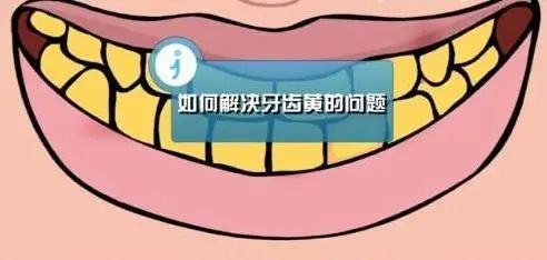 牙齿为什么会变黄?这个小妙招让你牙齿白白~ 图片-4