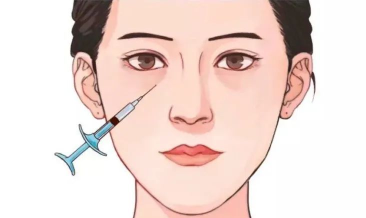讲真!做祛眼袋手术时，千万不能省这个钱 图片-6