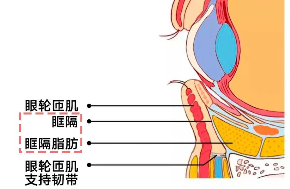 讲真!做祛眼袋手术时，千万不能省这个钱 图片-4