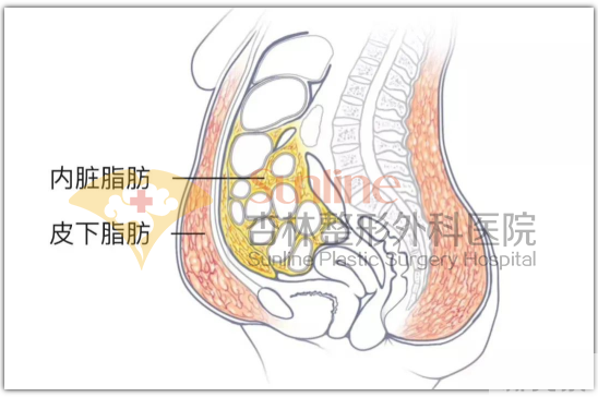 科普 | 吸脂前你需要知道这些! 图片-8