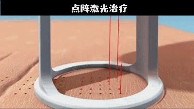 谁说毛孔粗大没有救了?我找到了细腻毛孔的办法 图片-7