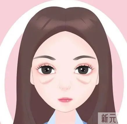 为什么你的卧蚕没别人的好看?因为那是眼袋啊! 图片-5