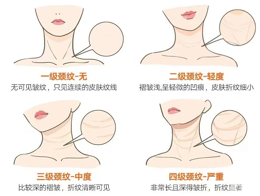 颈纹该做的项目是这个!可惜很多人搞错了...... 图片-3