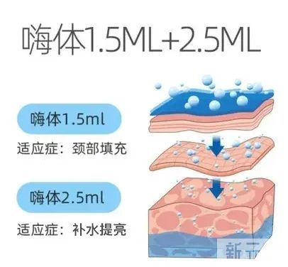颈纹该做的项目是这个!可惜很多人搞错了...... 图片-6
