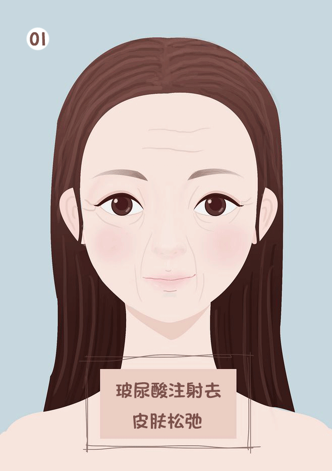 微整有话说丨大分子or小分子，玻尿酸有门道! 图片-15