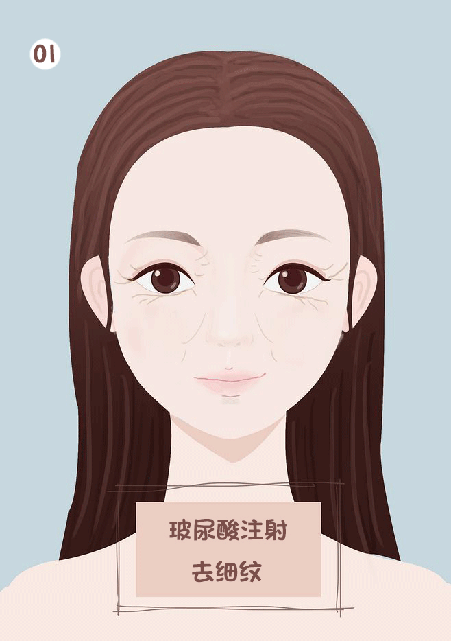 微整有话说丨大分子or小分子，玻尿酸有门道! 图片-17