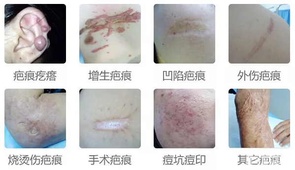 「疤痕恢复期」这样吃，美味又健康! 图片-5