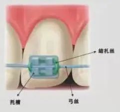 成人矫正也有黄金期吗?效果好不好? 图片-4