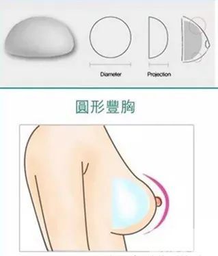 哪个年龄段适合做假体隆胸?如何才能大的自然?do胸前先看这一篇! 图片-5